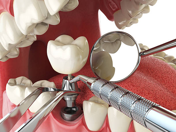 Best Cosmetic Emergency Dentistry in Maumee, OH
