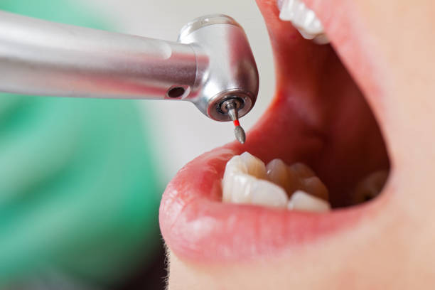 Best Emergency Dental Care for Broken or Chipped Teeth in Maumee, OH